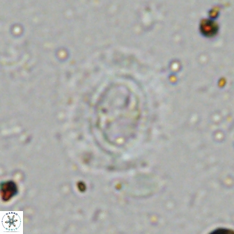 Ellipsagelosphaera lucasii 33160