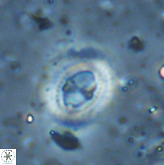 Ellipsagelosphaera lucasii 33162