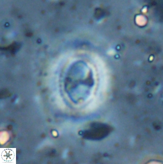 Ellipsagelosphaera lucasii 33163