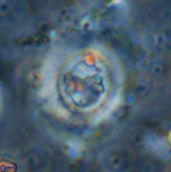 Ellipsagelosphaera lucasii 33170