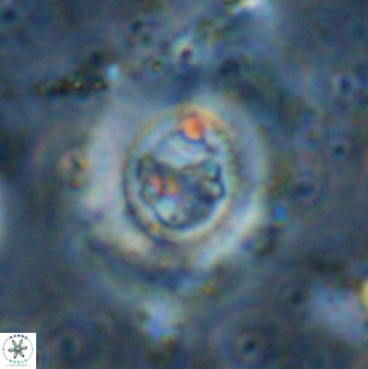 Ellipsagelosphaera lucasii 33170