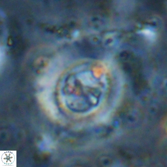 Ellipsagelosphaera lucasii 33171