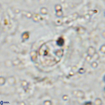 Ellipsagelosphaera lucasii 33172