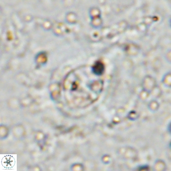 Ellipsagelosphaera lucasii 33172