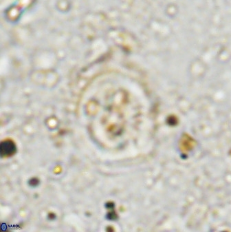 Ellipsagelosphaera supergesta 48145