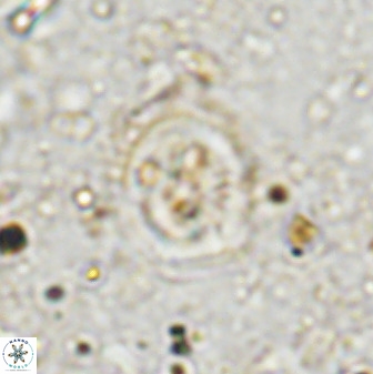 Ellipsagelosphaera supergesta 48145