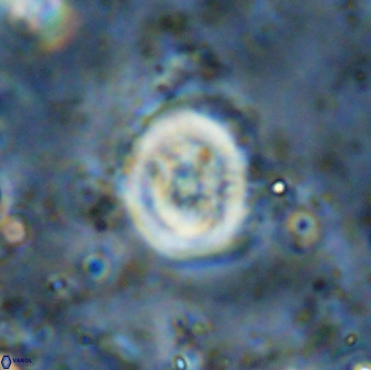 Ellipsagelosphaera supergesta 48146