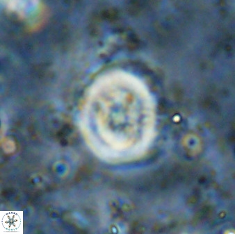 Ellipsagelosphaera supergesta 48146