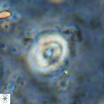 Ellipsagelosphaera supergesta 48147