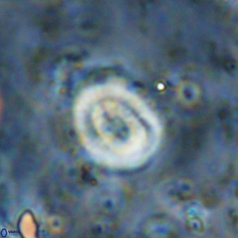 Ellipsagelosphaera supergesta 48150