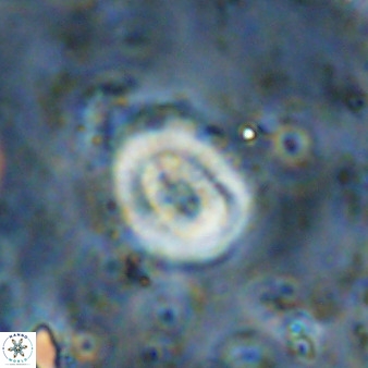 Ellipsagelosphaera supergesta 48150