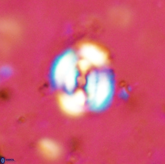 Ellipsagelosphaera supergesta 48134