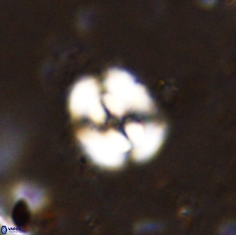 Ellipsagelosphaera supergesta 48136