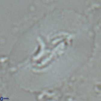 Ellipsolithus macellus 25633