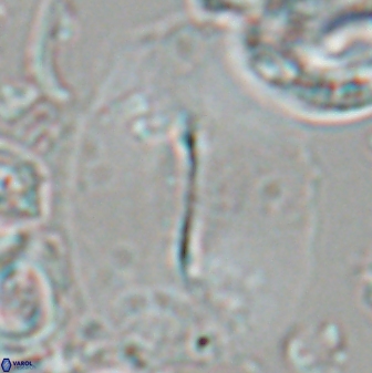 Ellipsolithus macellus 22462