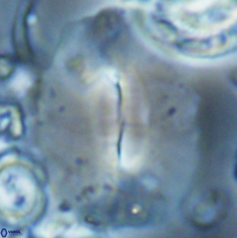 Ellipsolithus macellus 22463