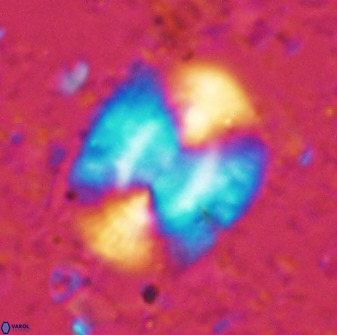 Ellipsolithus macellus 49050