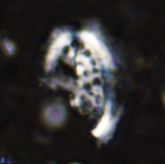 Ellipsolithus aubryae 49211