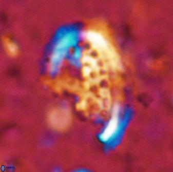 Ellipsolithus aubryae 49212