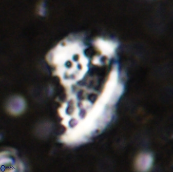 Ellipsolithus aubryae 49214