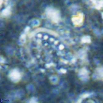 Ellipsolithus aubryae 49218