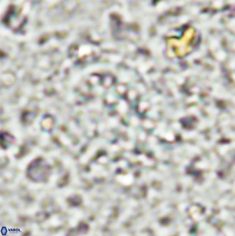 Ellipsolithus aubryae 49219