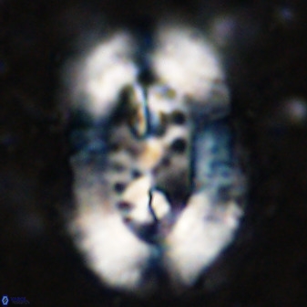 Ellipsolithus aubryae 49348