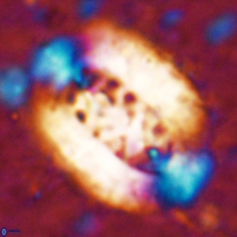 Ellipsolithus aubryae 49352