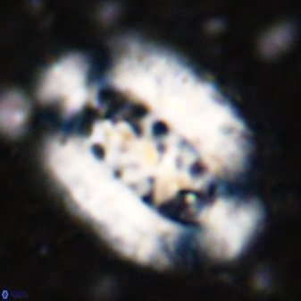 Ellipsolithus aubryae 49353