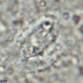 Ellipsolithus aubryae 49354