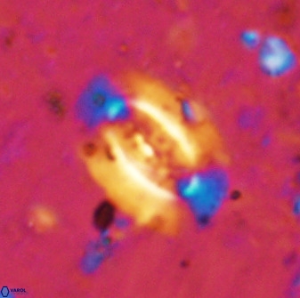 Ellipsolithus alabamaensis 50179