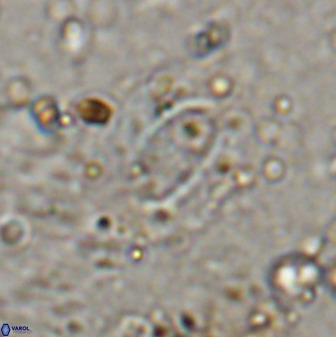 Ellipsolithus alabamaensis 50184