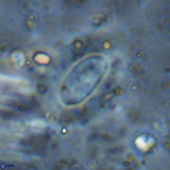 Ellipsolithus alabamaensis 50185