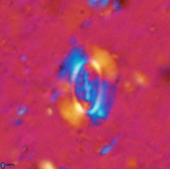 Ellipsolithus alabamaensis 50371