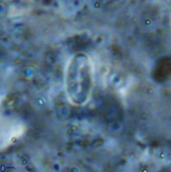 Ellipsolithus alabamaensis 50373