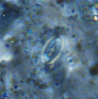 Ellipsolithus alabamaensis 50375