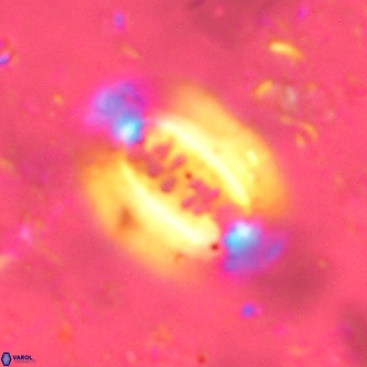 Ellipsolithus alabamaensis VR 01451