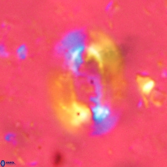 Ellipsolithus alabamaensis VR 01452