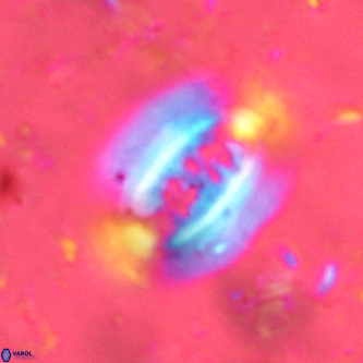 Ellipsolithus alabamaensis VR 01455