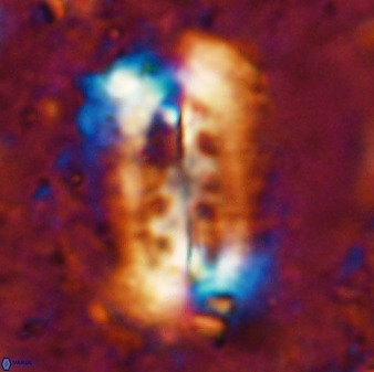 Ellipsolithus distichus 49625