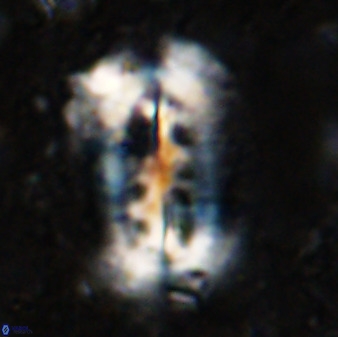 Ellipsolithus distichus 49626