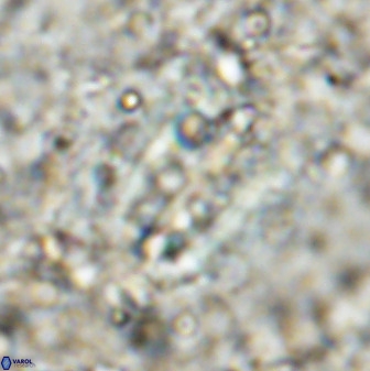 Ellipsolithus distichus 49630