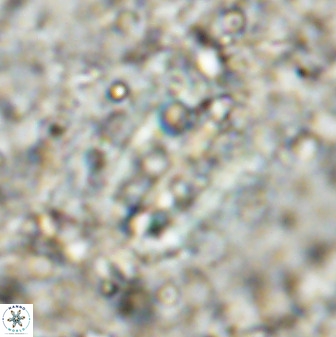 Ellipsolithus distichus 49630
