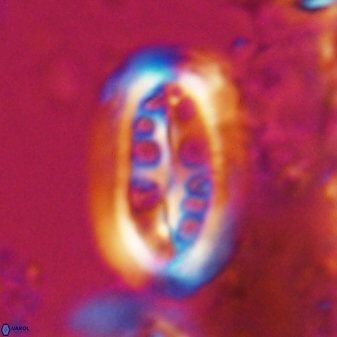 Ellipsolithus distichus 23391