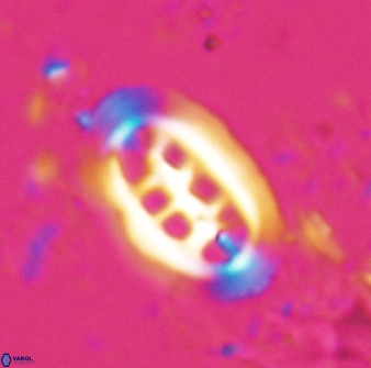 Ellipsolithus distichus 24757