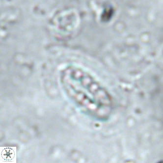 Ellipsolithus distichus VR 01445