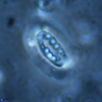 Ellipsolithus distichus VR 01449