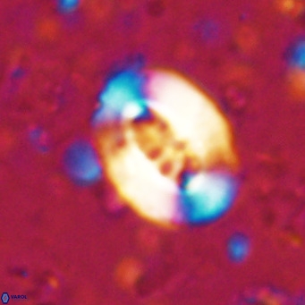 Ellipsolithus lajollaensis VR 025509