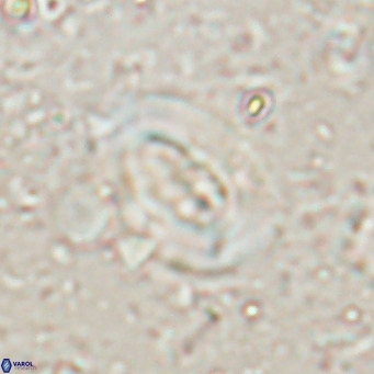 Ellipsolithus lajollaensis VR 025517