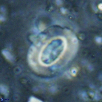 Ellipsolithus lajollaensis VR 025522